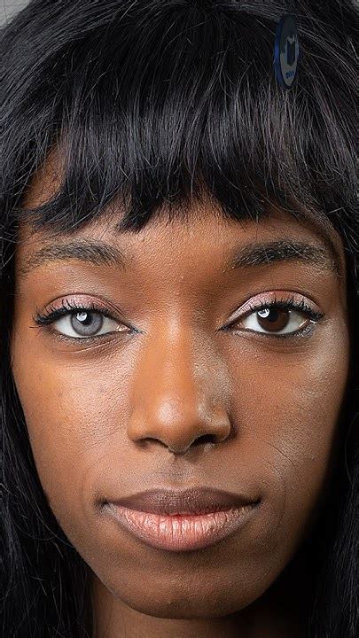 Heterochromia: Why Do Some People Have Differently.
